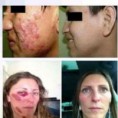 /album/algunos-resultados-reales/a11208259-384075528466678-1516445602-n-copia-copia-jpg/